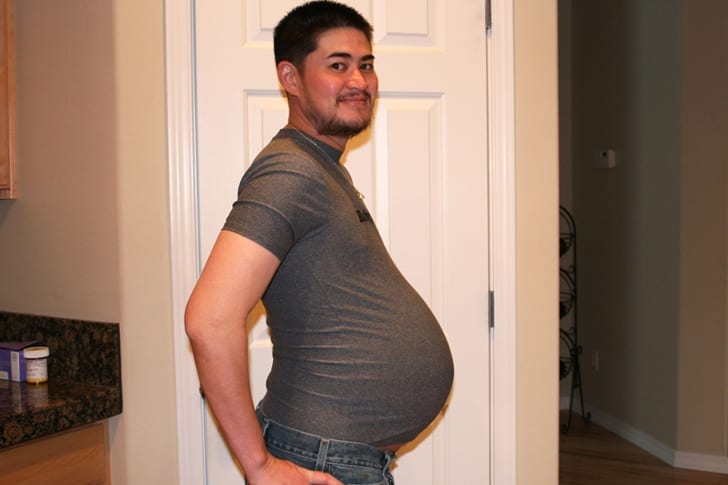 The Worlds First Pregnant Man Years After His Controversial Conception Editors Nation